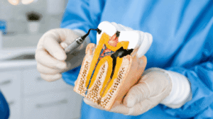 Diabetes and Gum Disease, The Two-Way Relationship